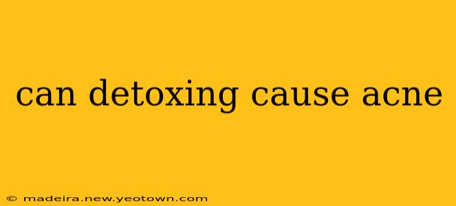 can detoxing cause acne