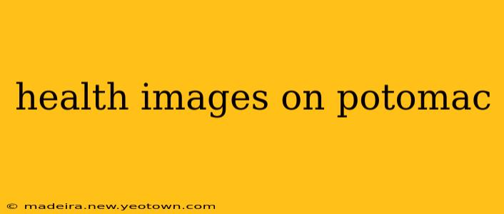 health images on potomac