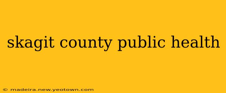 skagit county public health