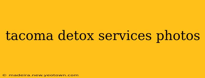 tacoma detox services photos