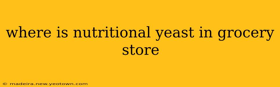 where is nutritional yeast in grocery store