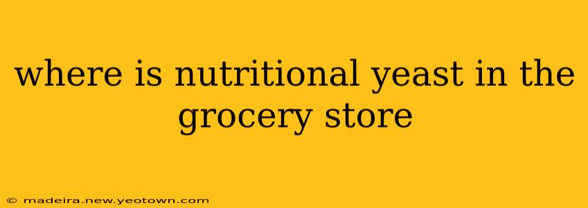 where is nutritional yeast in the grocery store