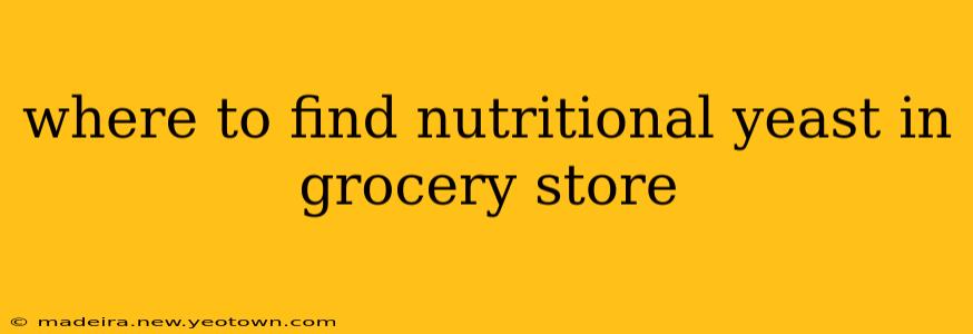 where to find nutritional yeast in grocery store