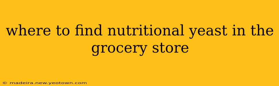 where to find nutritional yeast in the grocery store