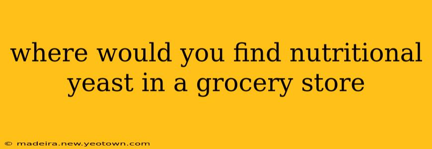 where would you find nutritional yeast in a grocery store